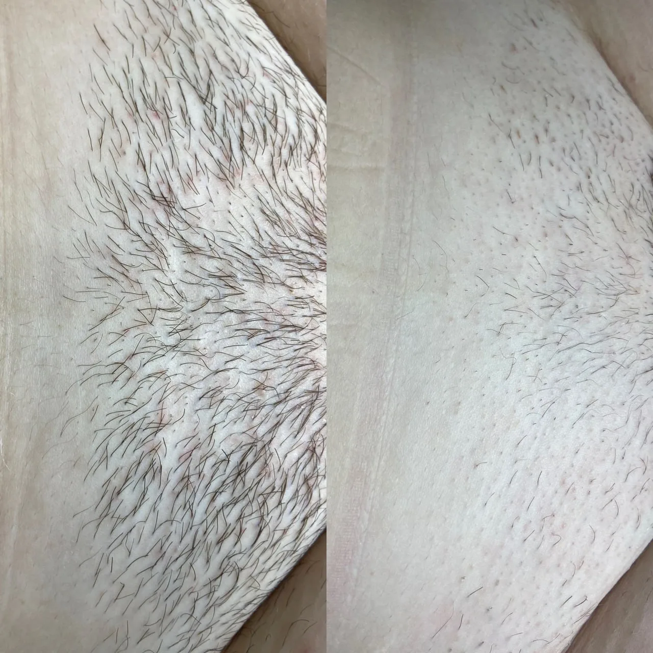 Skin care near Huntington Beach CA