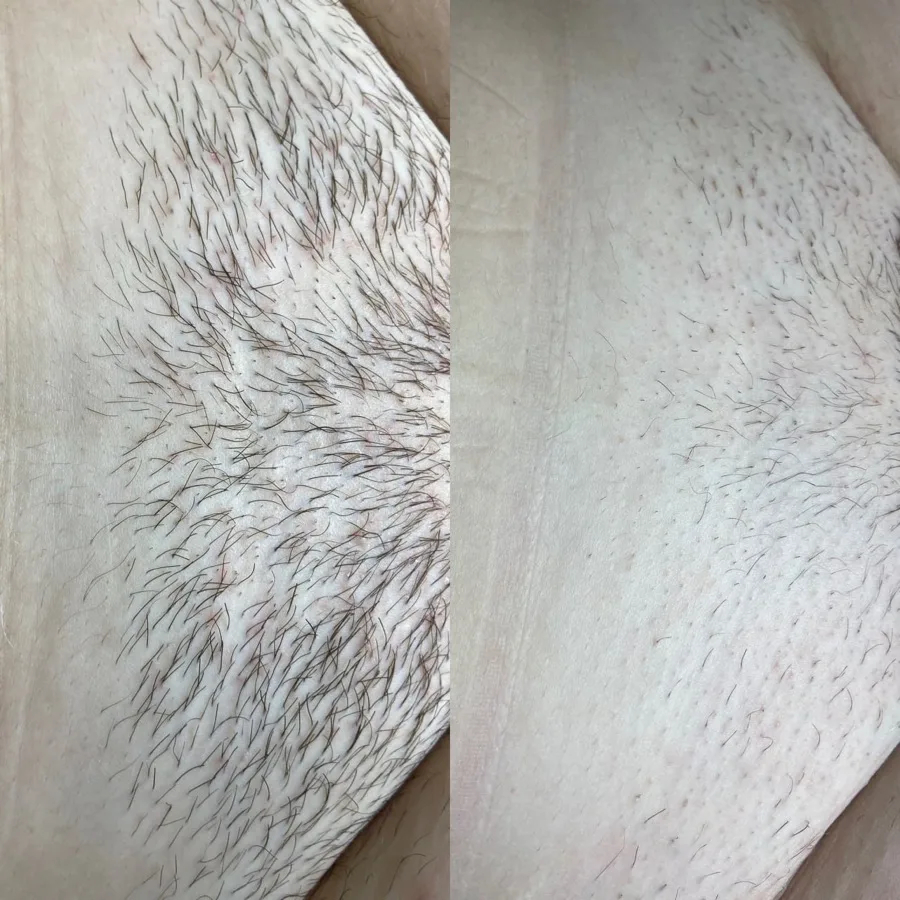Skin care near Laguna Beach CA