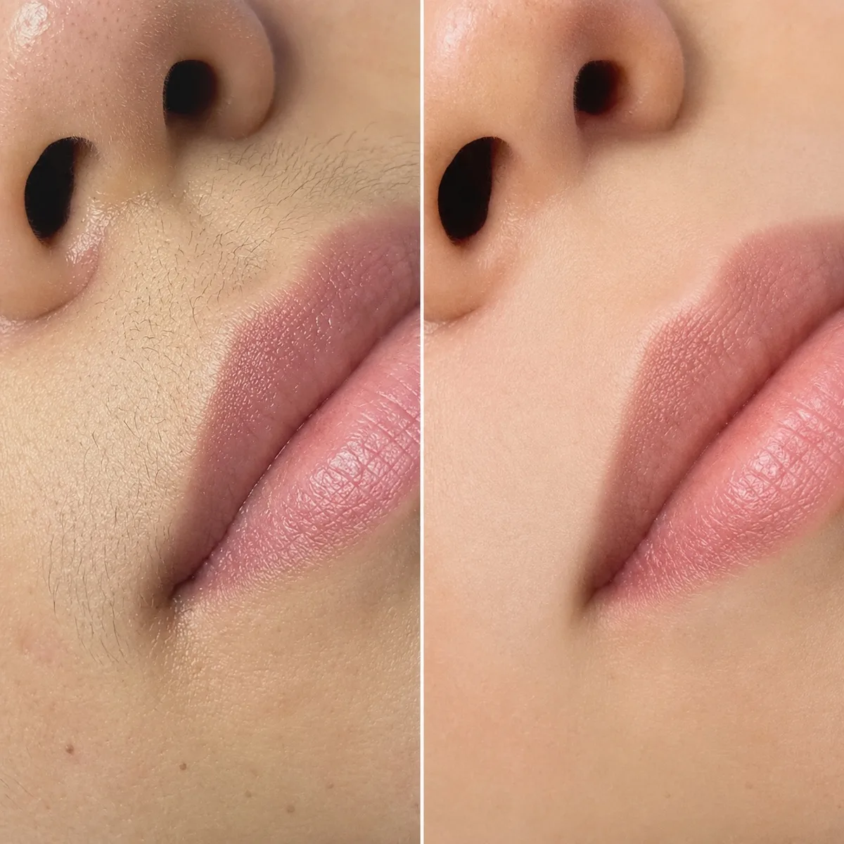 Face waxing before and after results in Irvine California