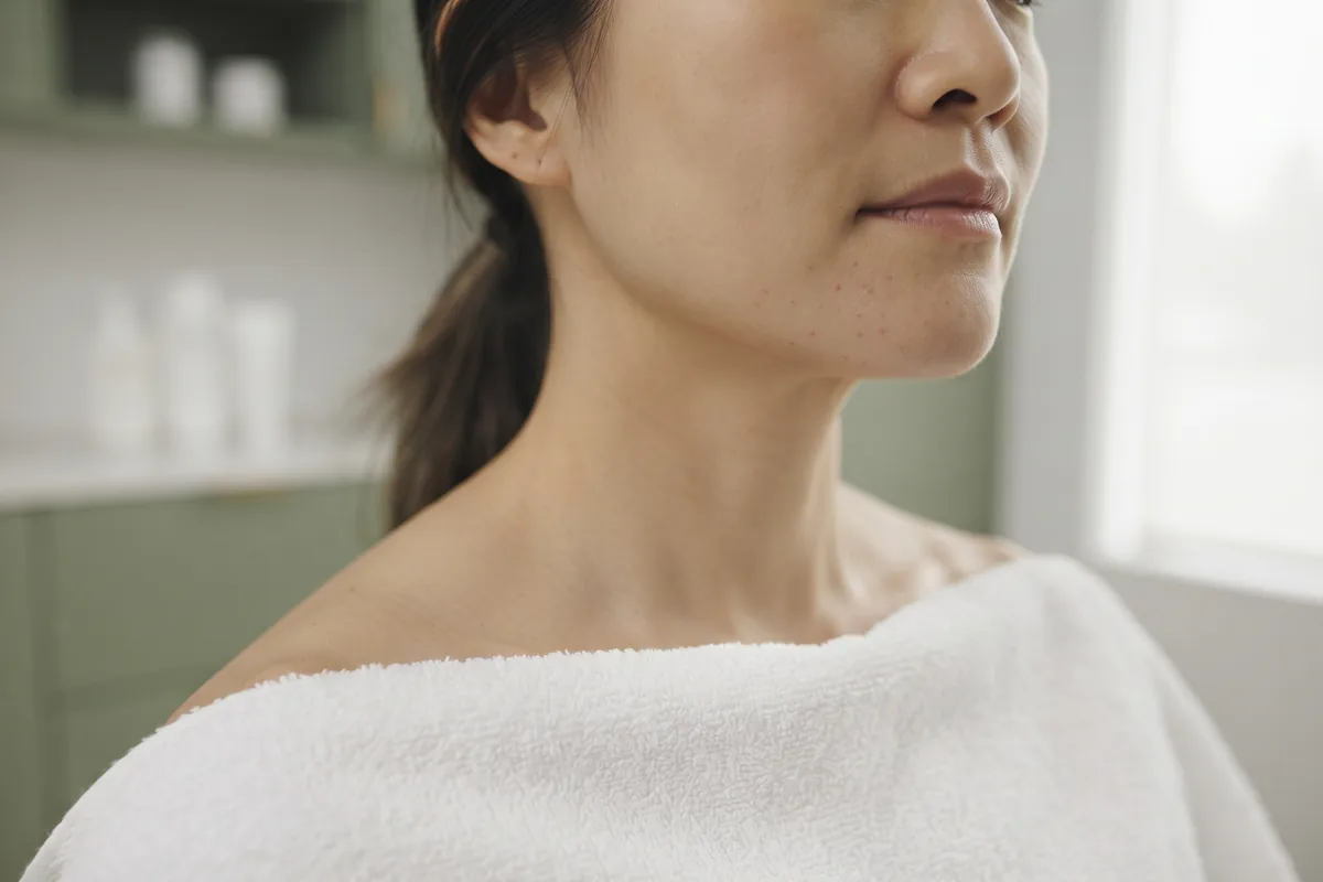 Close view of calm healthy skin on the chin with a few faint pink dots after electrolysis in Irvine CA